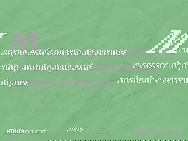 Meu corpo está coberto de vermes
e cascas de ferida,
minha pele está rachada
e vertendo pus. -- Jó 7:5