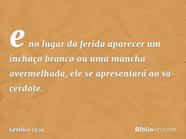 e no lugar da ferida aparecer um inchaço branco ou uma man­cha avermelhada, ele se apresentará ao sa­cerdote. -- Levítico 13:19